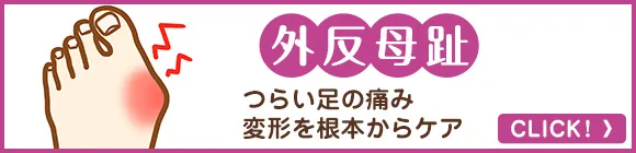 外反母趾・つらい足の痛み・変形を根本からケア